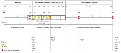 Continuous theta burst stimulation for drug-resistant epilepsy